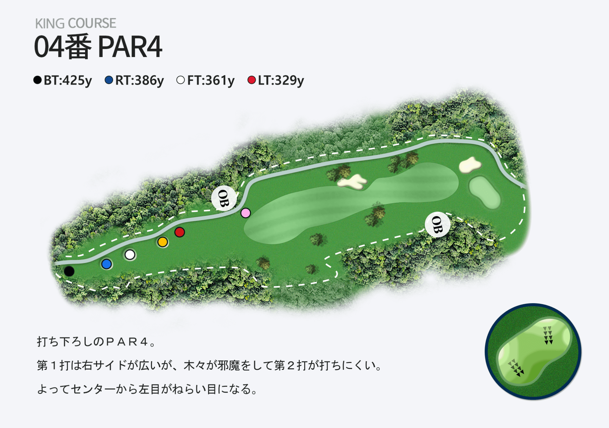 04番 PAR4