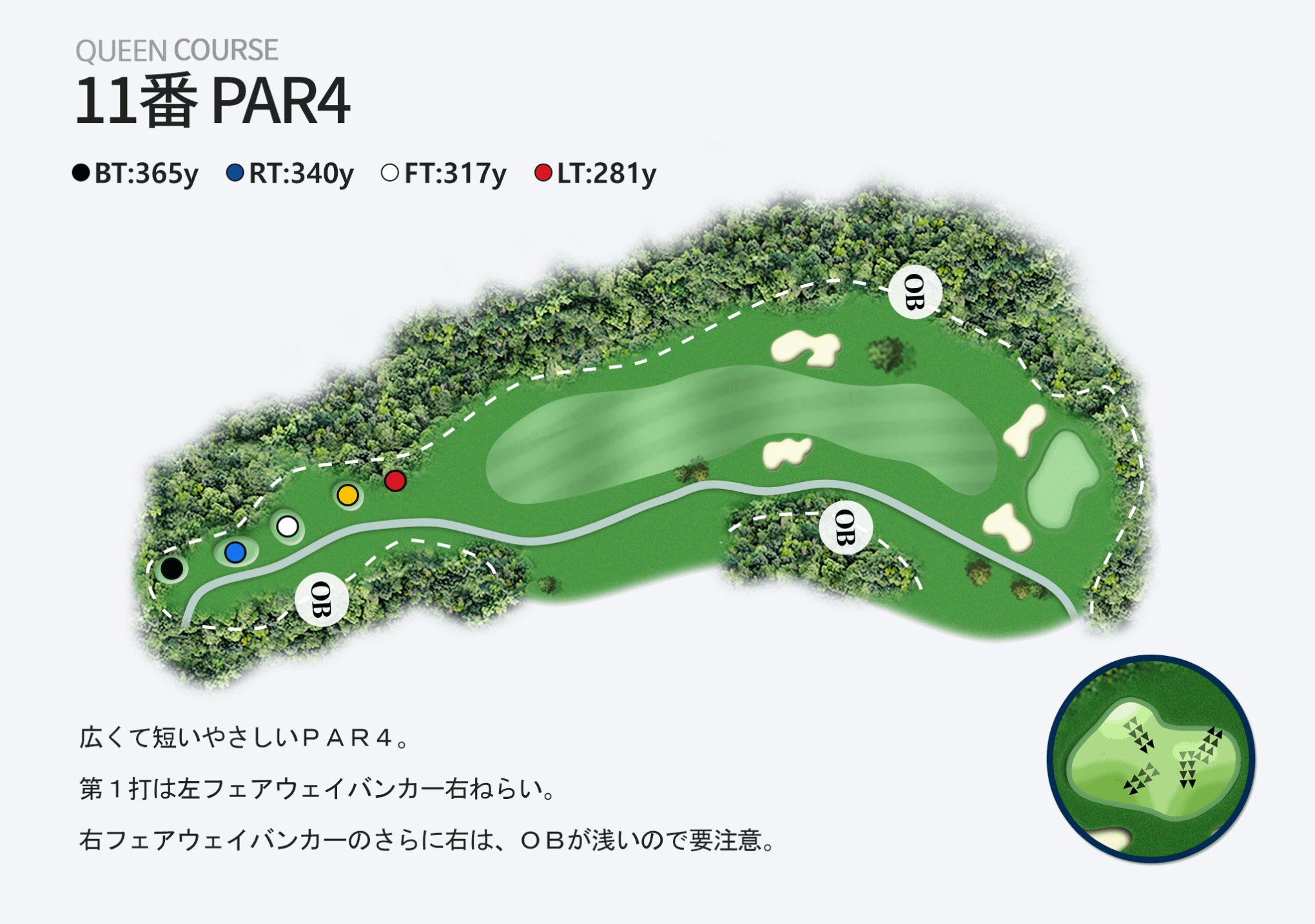 11番 PAR4