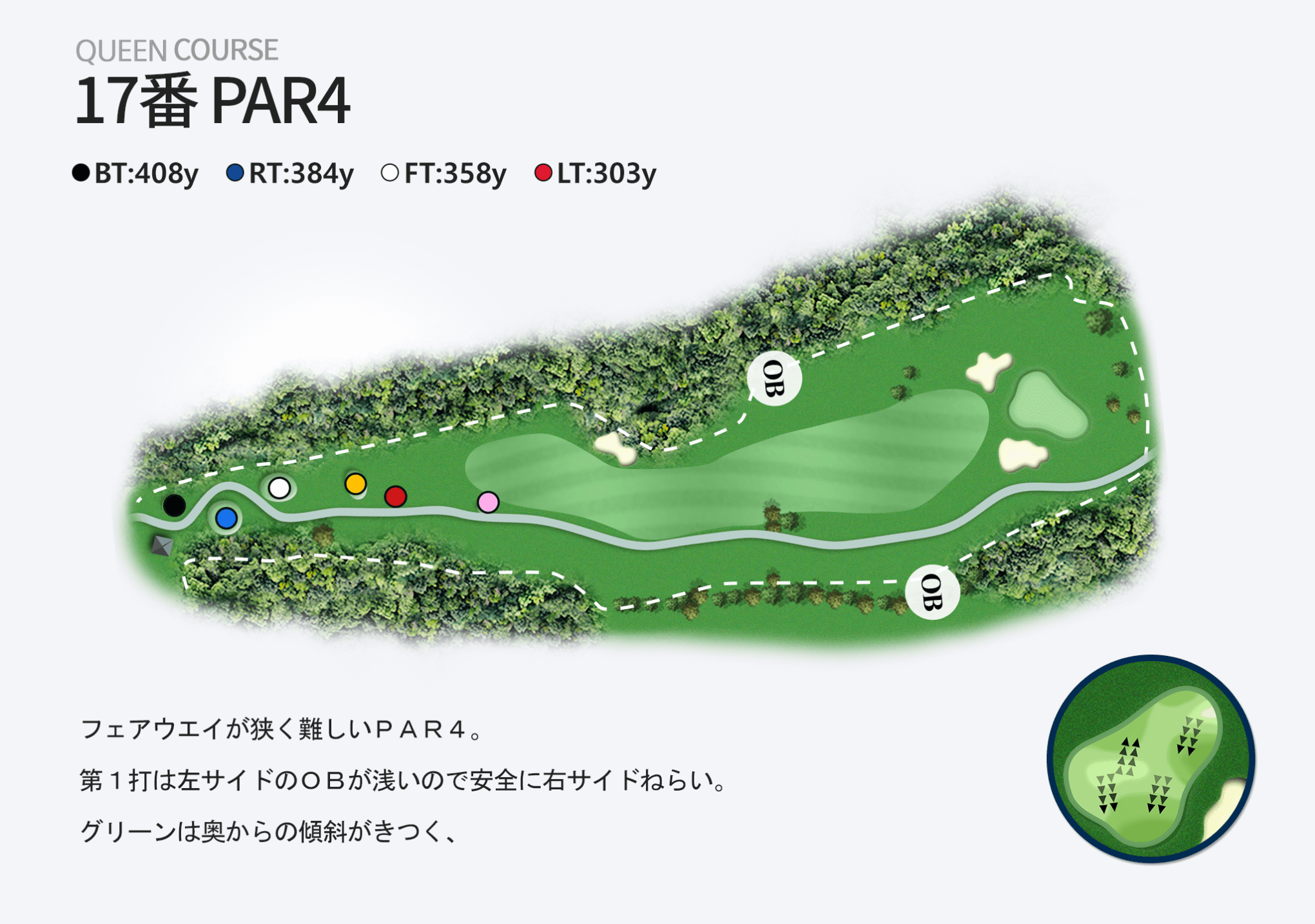 17番 PAR4