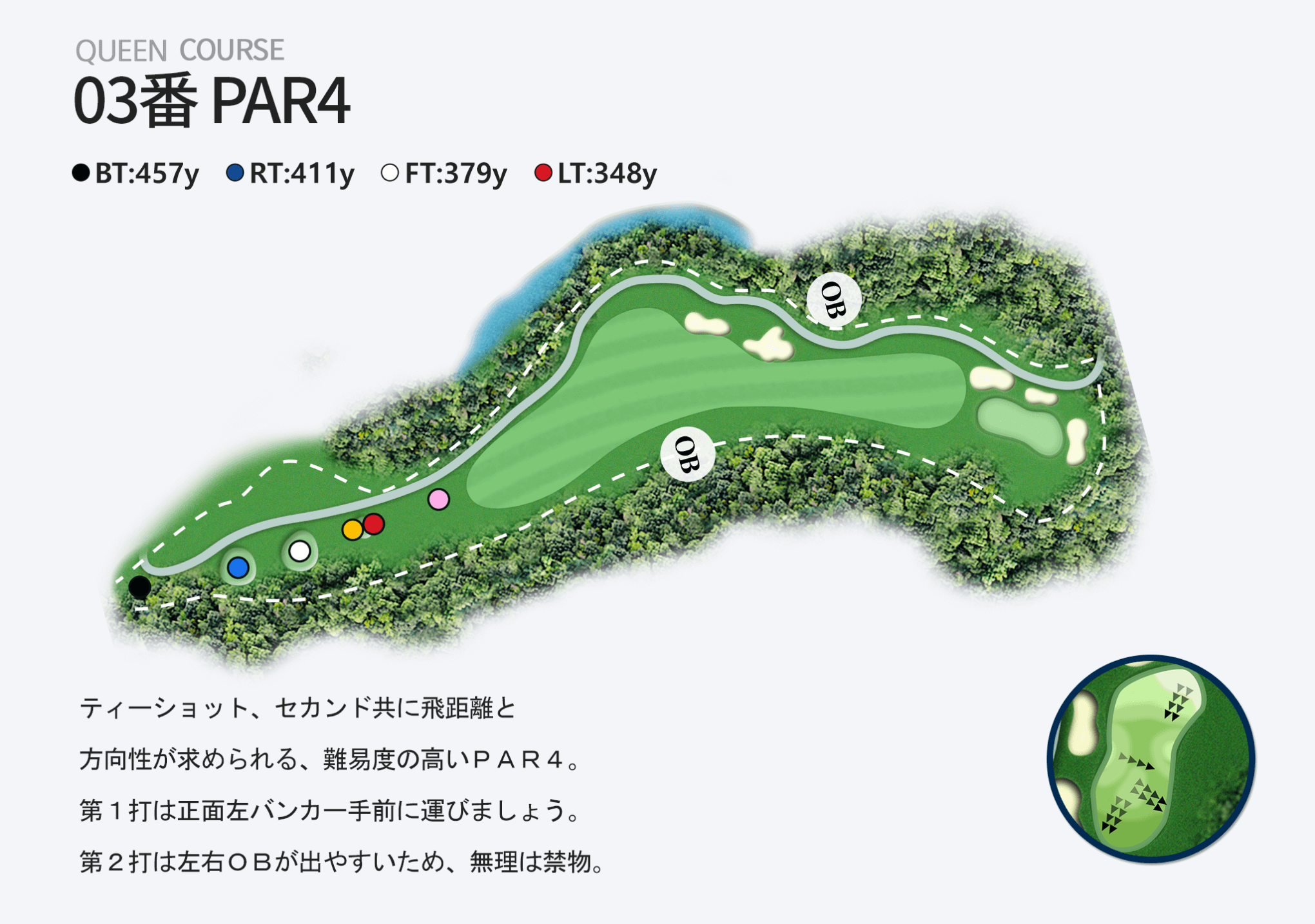 03番 PAR4