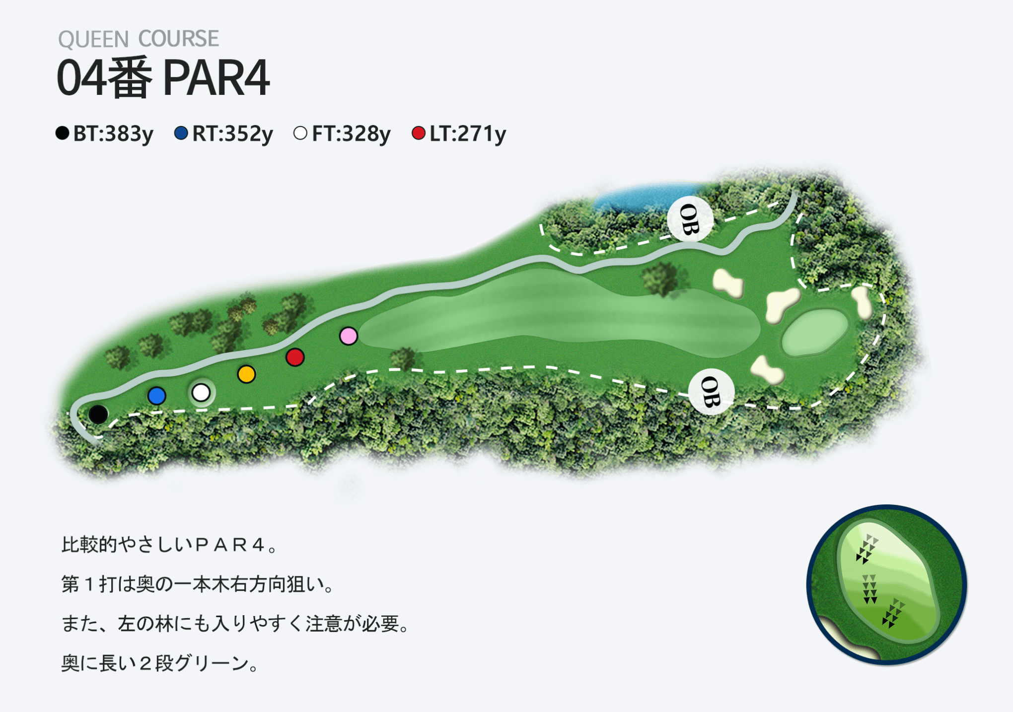 04番 PAR4